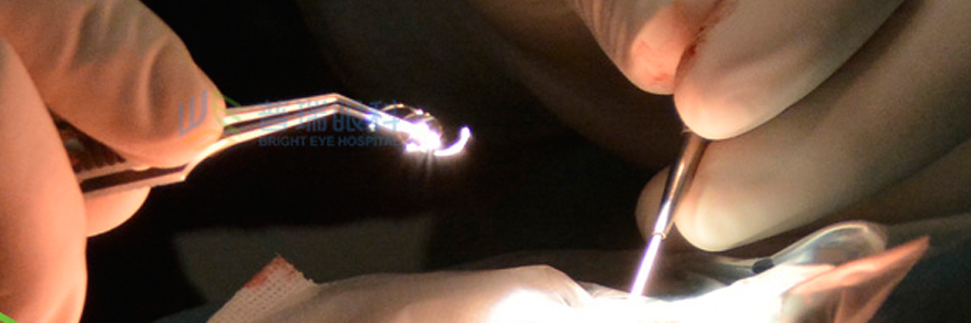 老人看不清，霧蒙蒙，視力逐漸下降這有可能是白內(nèi)障眼病