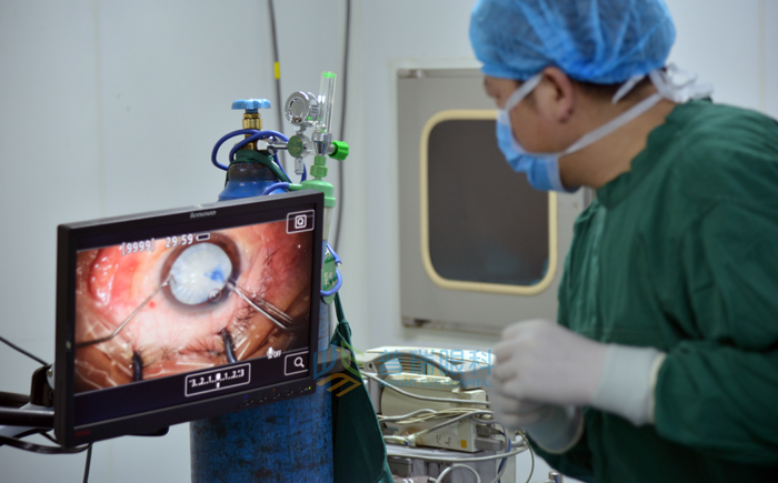 文字版，白內(nèi)障手術(shù)過程要看看哦