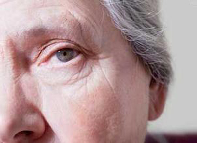 為什么我們?nèi)藲q數(shù)大了會(huì)得白內(nèi)障?