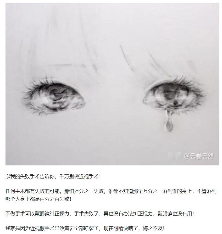 教你，怎樣去了解近視手術  